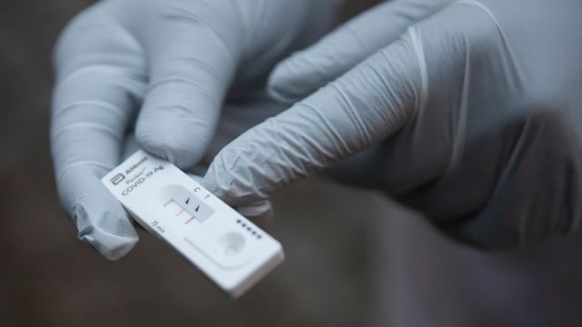 Schulen melden Positiv-Tests nicht mehr